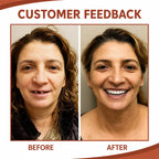 Denture Cushions | Soft Silicone Non-Slip | Adjustable