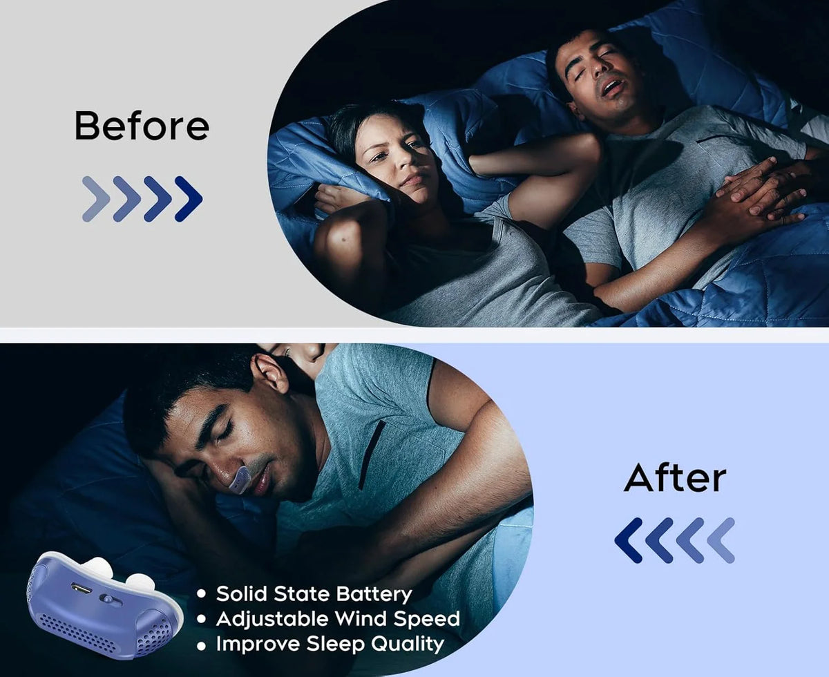Micro CPAP Machine | USB-Rechargeable Whisper-Quiet Soft Silicone Buds