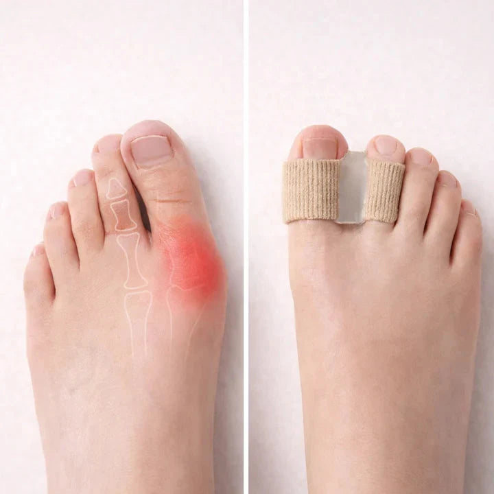 Toe Separators | Gel Pain Relief & Slim Fit | Pair